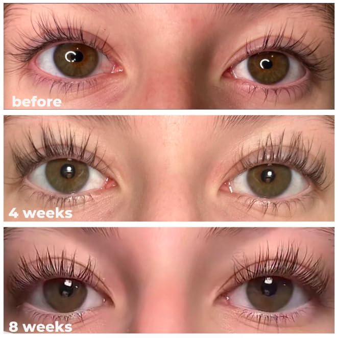 Eyelash Serum