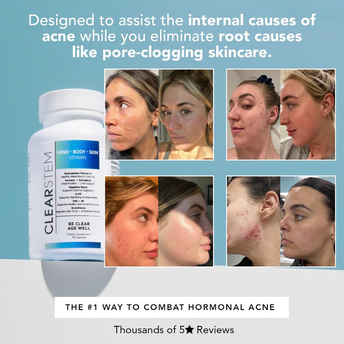 ClearSkin Balance Capsules