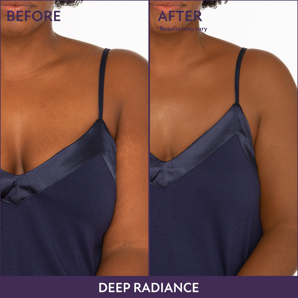 Body Coverage Cream + Free Brush