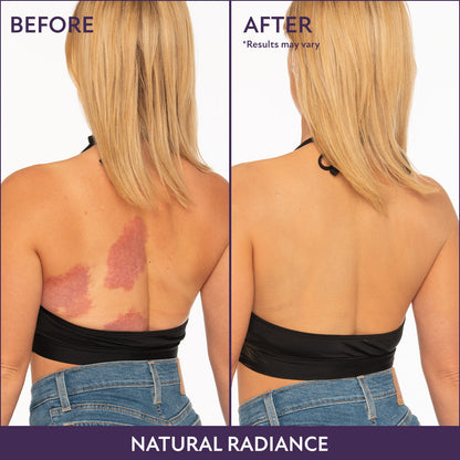 Body Coverage Cream + Free Brush